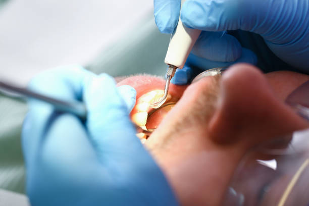 Best Emergency Cosmetic Dentistry in Knightdale, NC