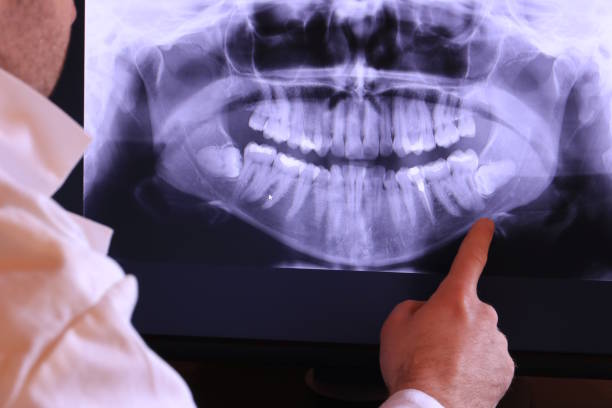 Best Broken or Cracked Tooth Emergency Dentist in Knightdale, NC
